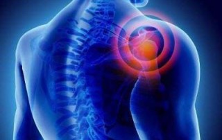 Shoulder Pain Treatment