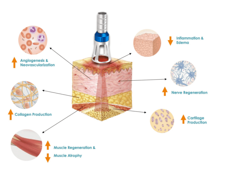 biological benefits of class 4 laser therapy