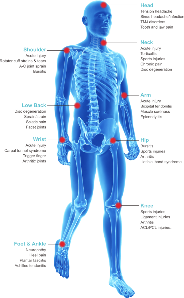 High Power Class IV Laser Therapy Machine and Equipment for ...