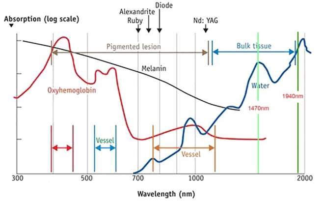 Absorption and Wavelength of EVLT Laser